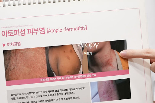 생기한의원으로 살펴보는 아토피 다리 부위 증상 확인 포인트
